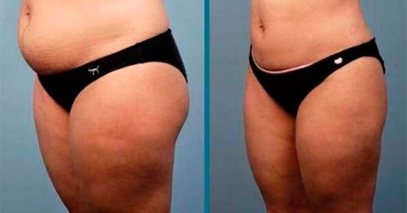 módszerek egy hónap alatt 10 kilogramm fogyáshoz
